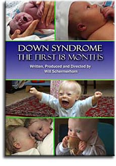 Cover illustration of Down Syndrome: The First 18 Months DVD.